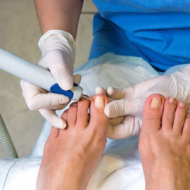 How-Can-You-Get-Toenails-to-Grow-Straight